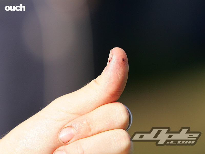 neil round broke a driver, which then went right through his thumb